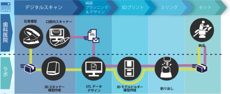 保険適用のCAD/CAM冠 | 歯科技工所 中央ラボ | 東京都八王子市